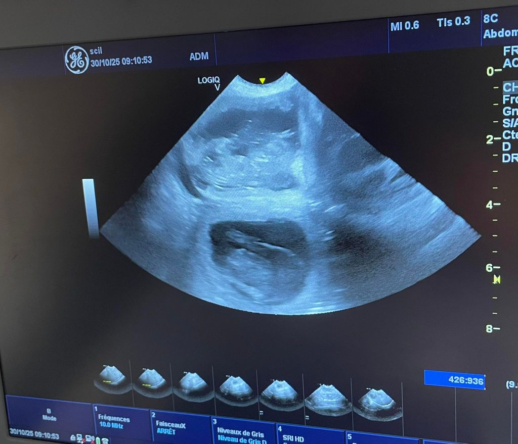 Des bébés arrivent en Novembre 